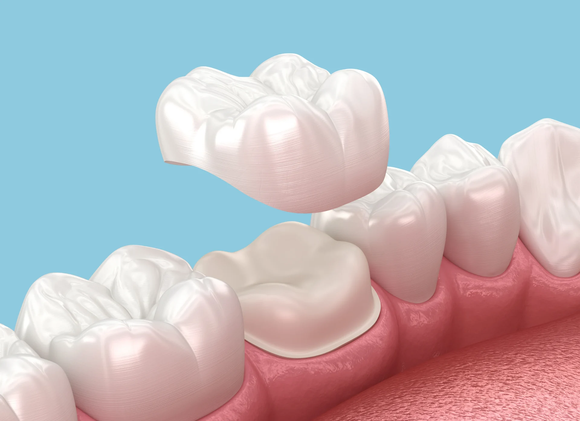 Dentist Lacey WA